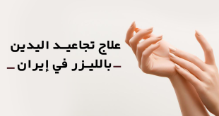 علاج تجاعيد اليدين بالليزر في إيران: الفوائد، التعافي