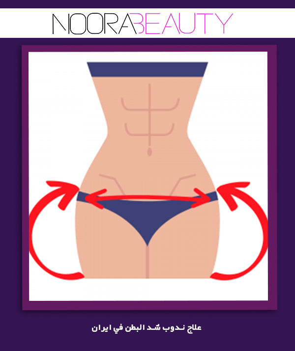 علاج ندوب شد البطن في ايران