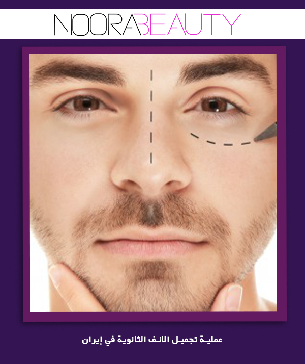 عملية تجميل الانف الثانوية في إيران