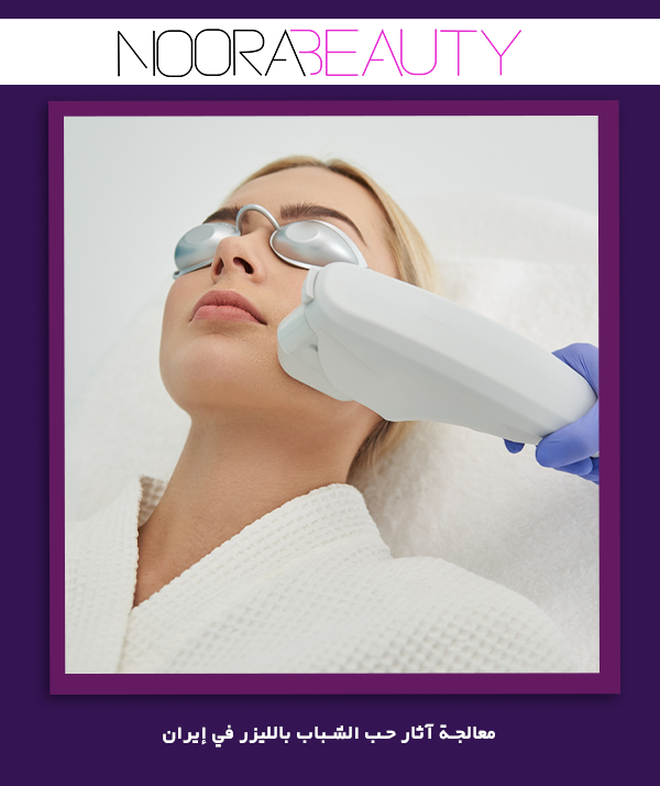 معالجة آثار حب الشباب بالليزر في إيران